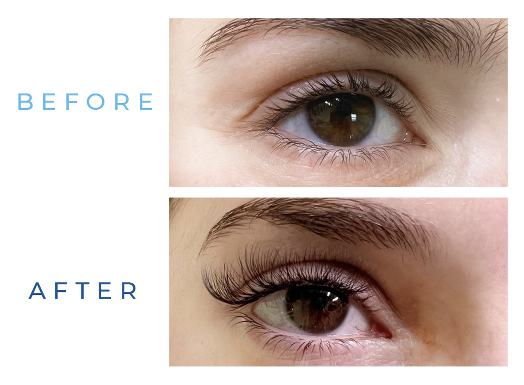 Smithfield Aesthetics - Lash Extensions Before & After