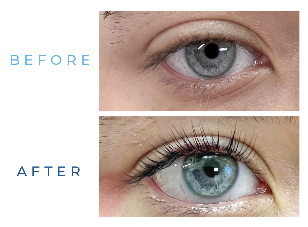 Smithfield Aesthetics - Lash Lift and Tint Before & After